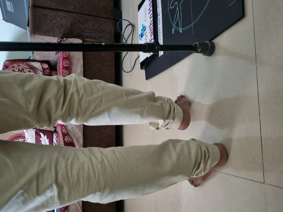 Limb length discrepancy