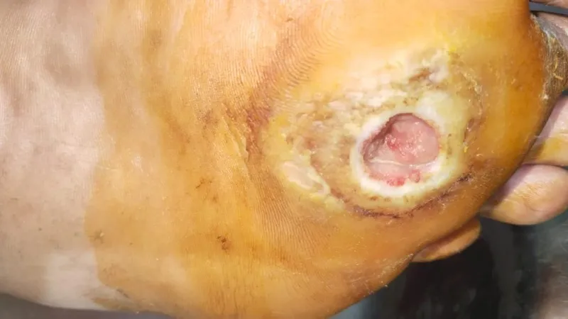 Treated Condition 10