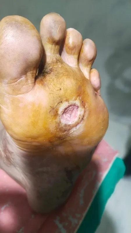 Treated Condition 12