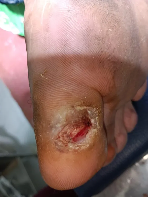 Treated Condition 13