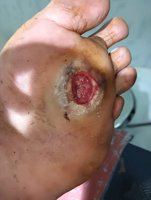 Treated Condition 20