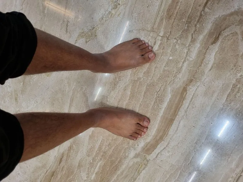 Treated Condition 27
