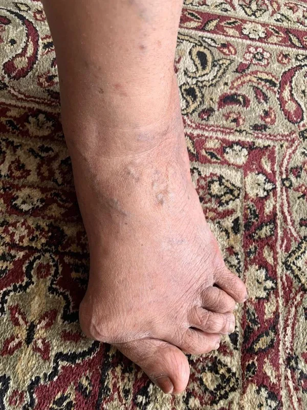 Treated Condition 29