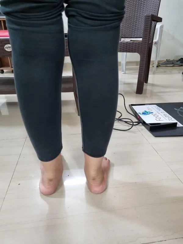 Treated Condition 33
