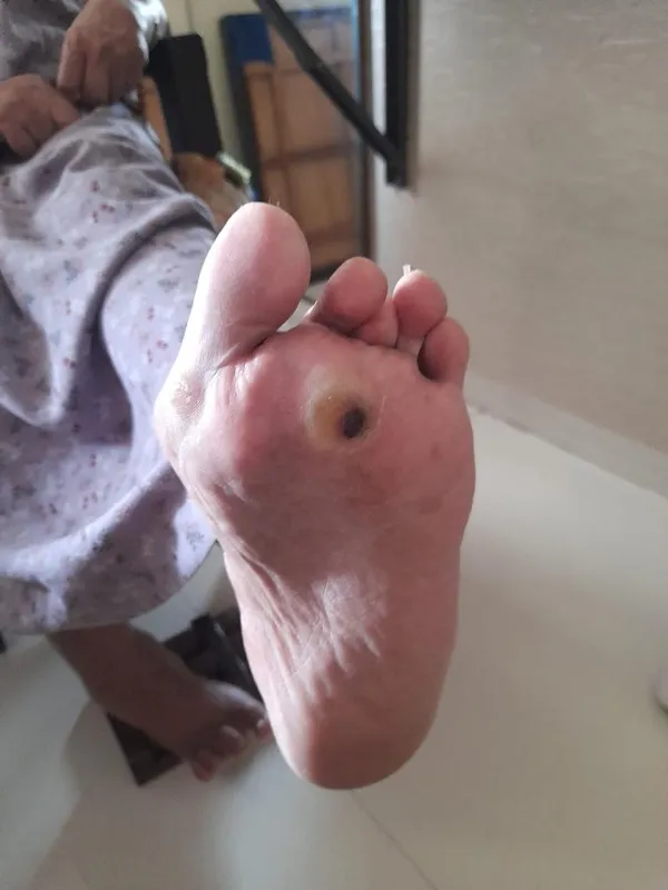 Treated Condition 39