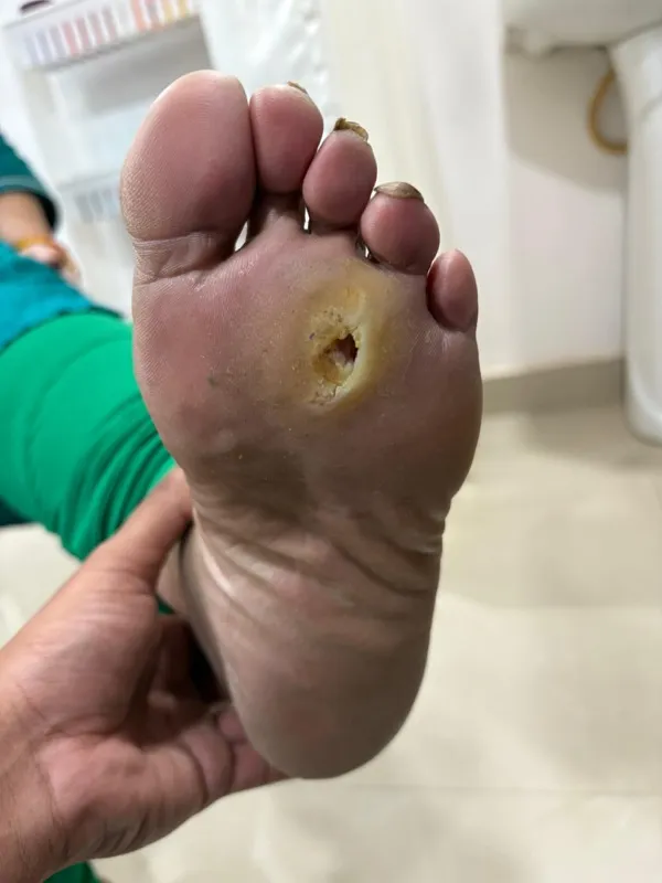 Treated Condition 4