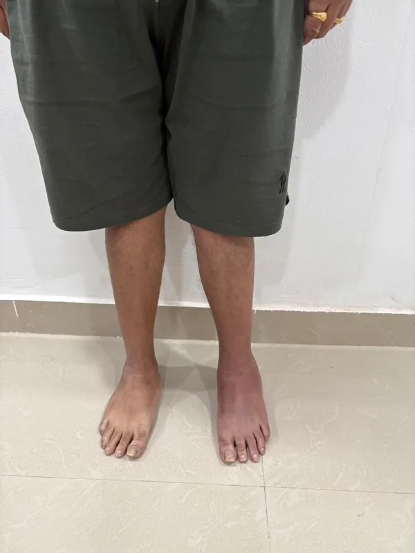 Treated Condition 43