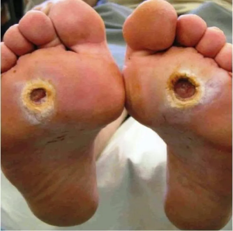 Treated Condition 47