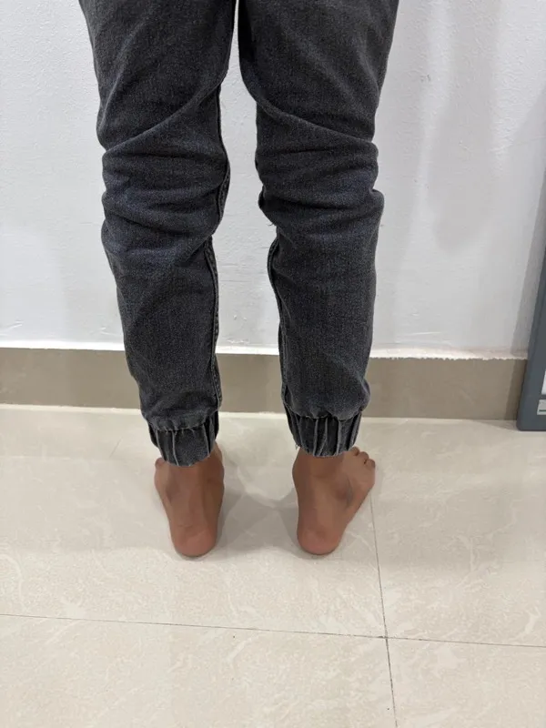 Treated Condition 49