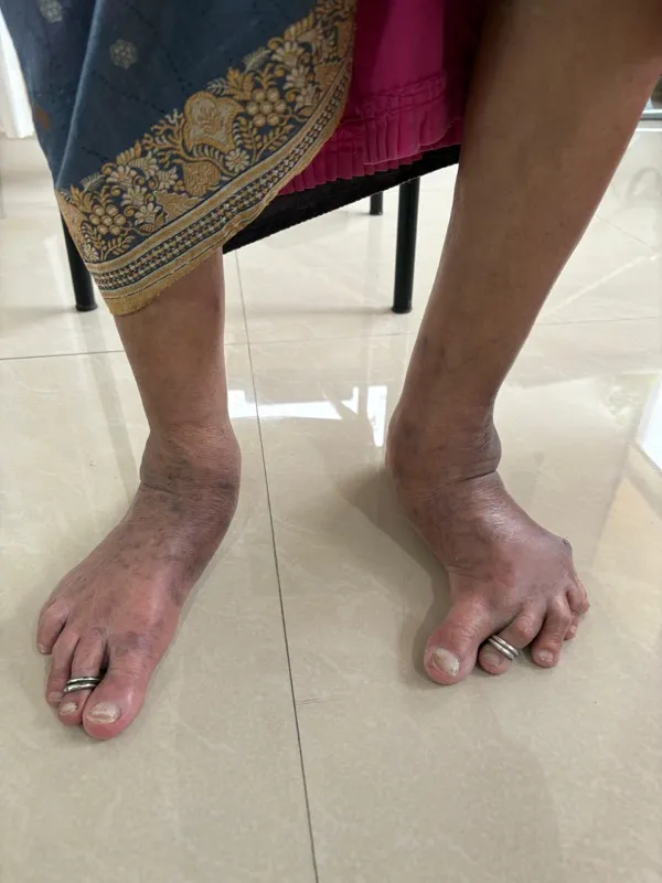 Treated Condition 5