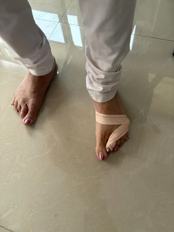 Treated Condition 50
