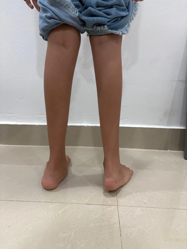 Treated Condition 53