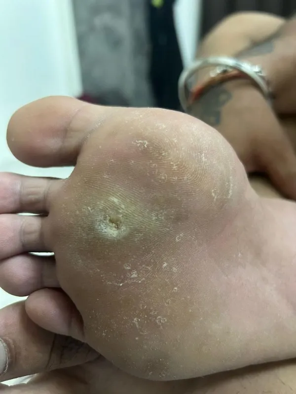 Treated Condition 54