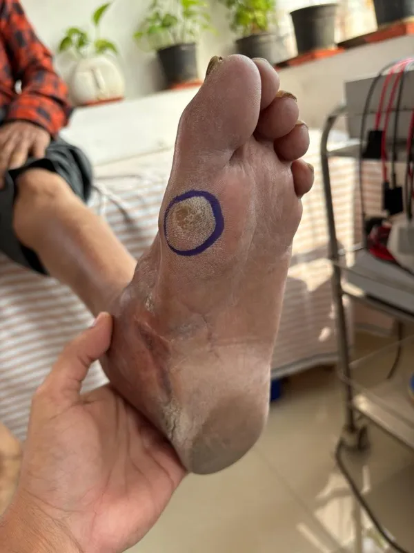 Treated Condition 59