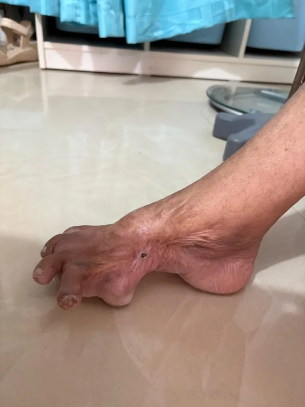 Treated Condition 62