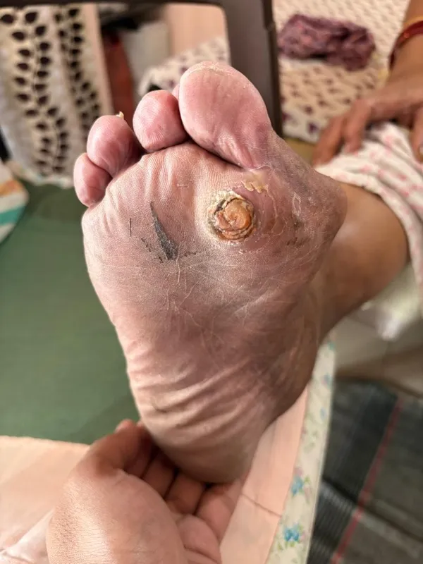 Treated Condition 63