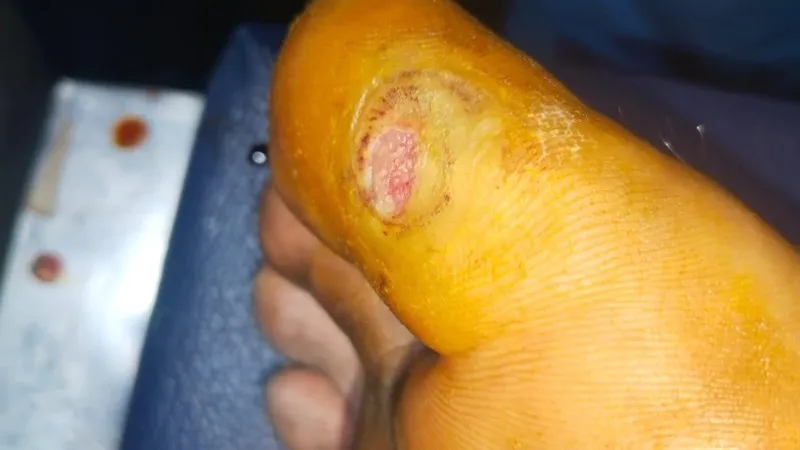 Treated Condition 8